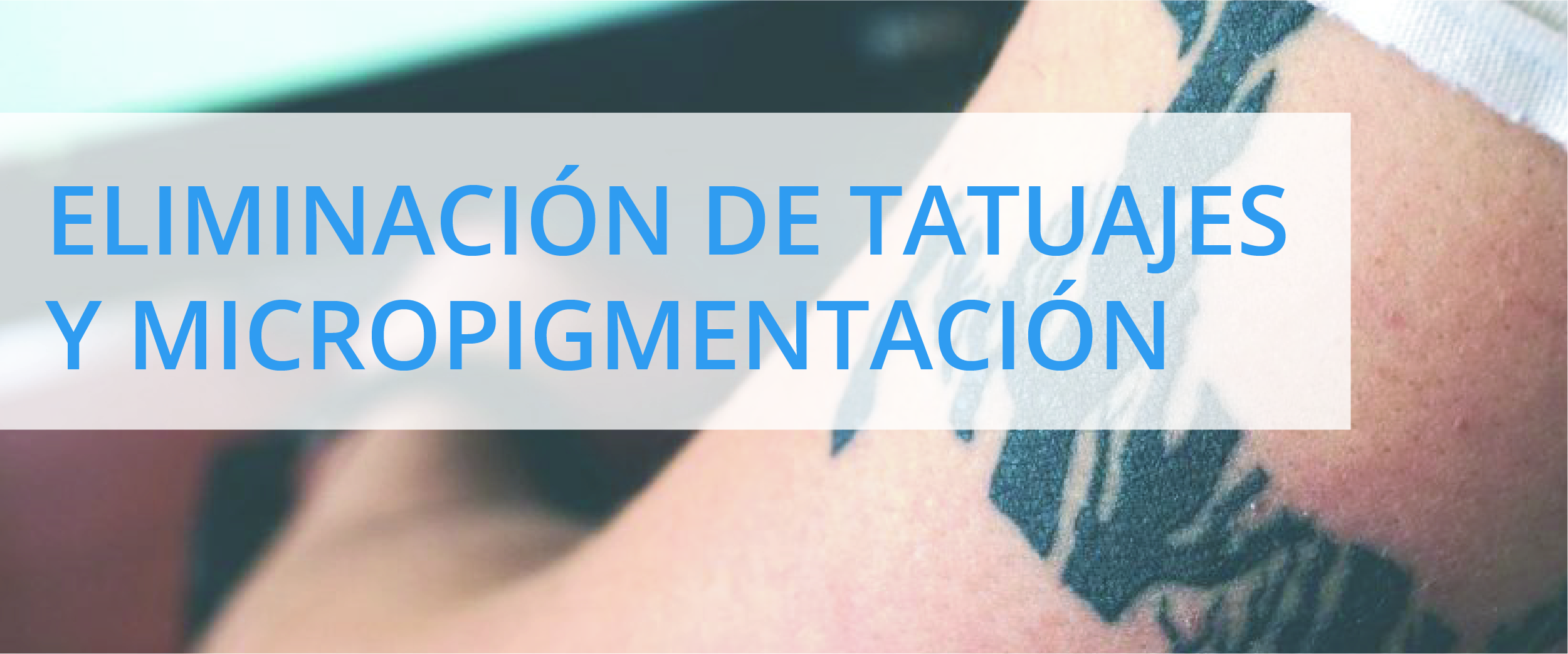 Eliminación de tatuajes y micropigmentación